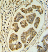 AP52011PU-N - HCCS / CCHL