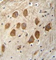 AP52012PU-N - HCFC1R1 / HPIP