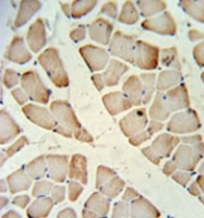 AP52036PU-N - HFE2 / Hemojuvelin
