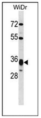 AP52061PU-N - HMG-CoA lyase / HMGCL