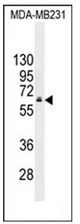 AP52066PU-N - HNF1 beta / TCF2