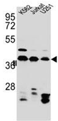AP52068PU-N - hnRNP-C1/C2 / HNRNPC