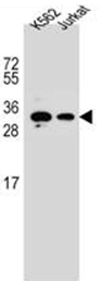AP52076PU-N - HOXA6 / HOX1B