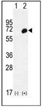 AP52089PU-N - Haptoglobin