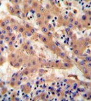 AP52089PU-N - Haptoglobin