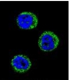 AP52089PU-N - Haptoglobin