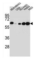 AP52089PU-N - Haptoglobin