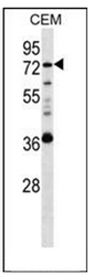 AP52095PU-N - Heparanase-2 / HPA2
