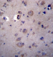 AP52095PU-N - Heparanase-2 / HPA2