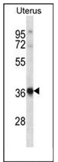AP52099PU-N - Histamine H2 receptor