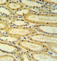 AP52109PU-N - 17-beta-HSD11 / HSD17B11