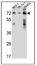 AP52112PU-N - 17-beta-HSD4 / HSD17B4