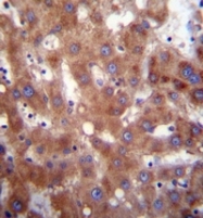 AP52112PU-N - 17-beta-HSD4 / HSD17B4