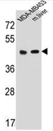 AP52130PU-N - Serotonin receptor 4 / HTR4