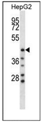 AP52132PU-N - HYAL1 / Hyaluronidase-1