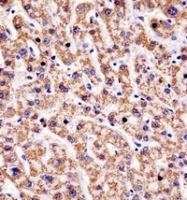 AP52132PU-N - HYAL1 / Hyaluronidase-1