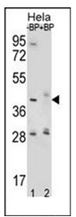 AP52133PU-N - HYAL2 / Hyaluronidase-2