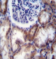 AP52133PU-N - HYAL2 / Hyaluronidase-2