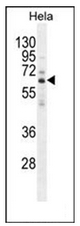 AP52134PU-N - HYAL2 / Hyaluronidase-2