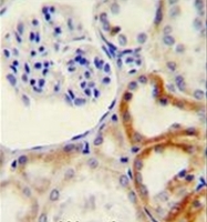 AP52134PU-N - HYAL2 / Hyaluronidase-2