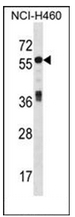 AP52139PU-N - Islet cell autoantigen 1 / ICA1