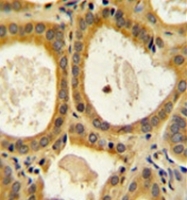 AP52146PU-N - CD152 / CTLA4