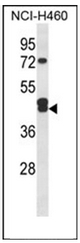 AP52147PU-N - Isocitric dehydrogenase gamma / IDH3G