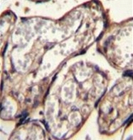 AP52163PU-N - Insulin-like growth factor II / IGF2