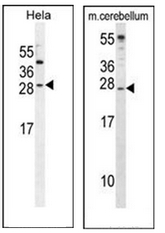 AP52163PU-N - Insulin-like growth factor II / IGF2
