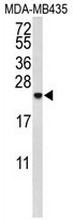 AP52181PU-N - Interleukin-10 / IL10