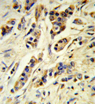 AP52181PU-N - Interleukin-10 / IL10