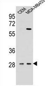 AP52183PU-N - Interleukin-12 beta / IL12B