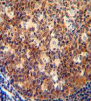 AP52183PU-N - Interleukin-12 beta / IL12B