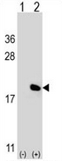AP52185PU-N - Interleukin-17A (IL17A)