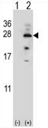 AP52186PU-N - Interleukin-17B / IL17B