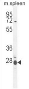 AP52186PU-N - Interleukin-17B / IL17B