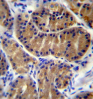 AP52186PU-N - Interleukin-17B / IL17B