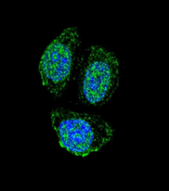 AP52186PU-N - Interleukin-17B / IL17B