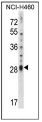 AP52187PU-N - Interleukin-17D / IL17D