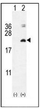 AP52188PU-N - Interleukin-17F / IL17F