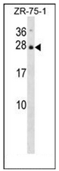 AP52193PU-N - Interleukin-25 / IL25