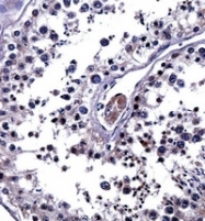 AP52193PU-N - Interleukin-25 / IL25