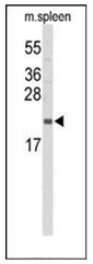 AP52198PU-N - Interleukin-31 / IL31