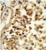 AP52198PU-N - Interleukin-31 / IL31