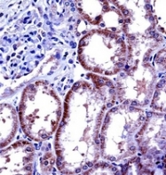 AP52199PU-N - Interleukin-6 / IL6