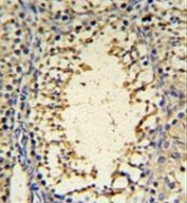 AP52205PU-N - IMP3