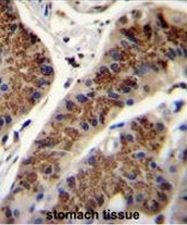 AP52211PU-N - Inhibin beta A chain (INHBA)