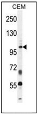 AP52214PU-N - INPP5B / 5PTase 2