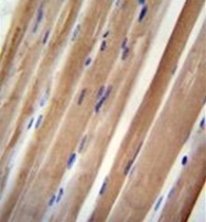 AP52214PU-N - INPP5B / 5PTase 2