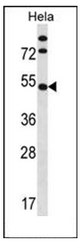 AP52220PU-N - InsP6 kinase 1 / IP6K1